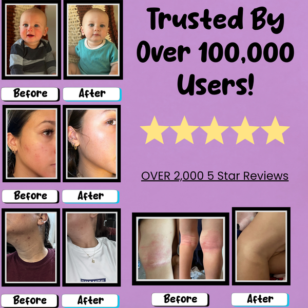 HolyCow Whipped Tallow Balm