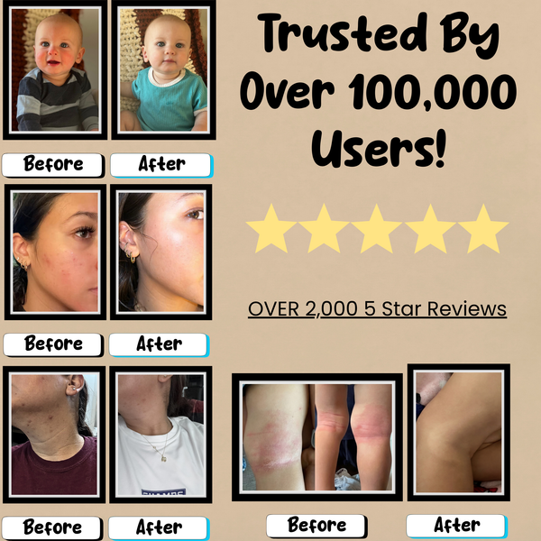 HolyCow Whipped Tallow Balm